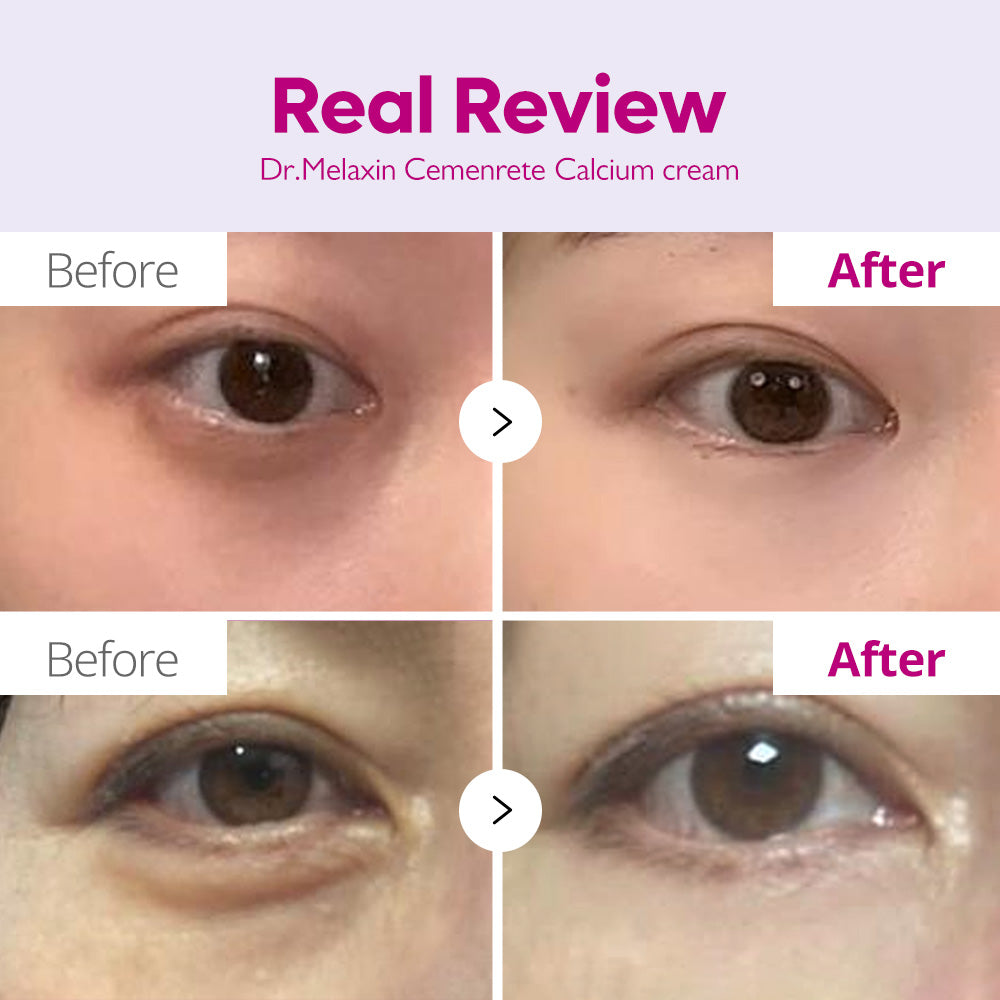 [FREE GIFT]🏆 #1 ON TIKTOK | 10-Step Skin Renewal Routine Set