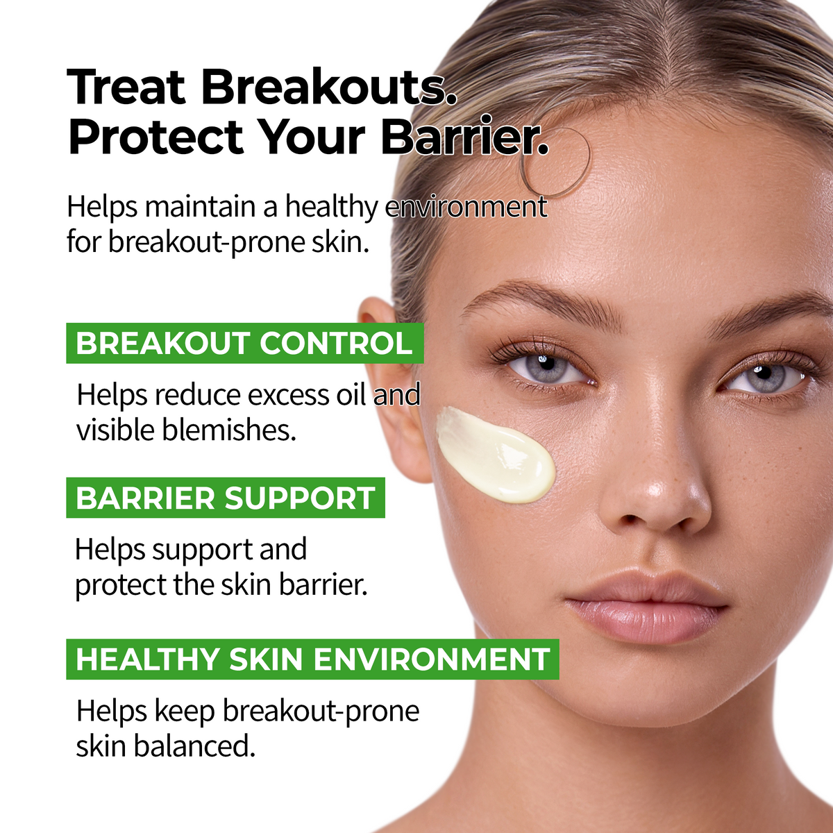 S-ZINC Blemish Cream