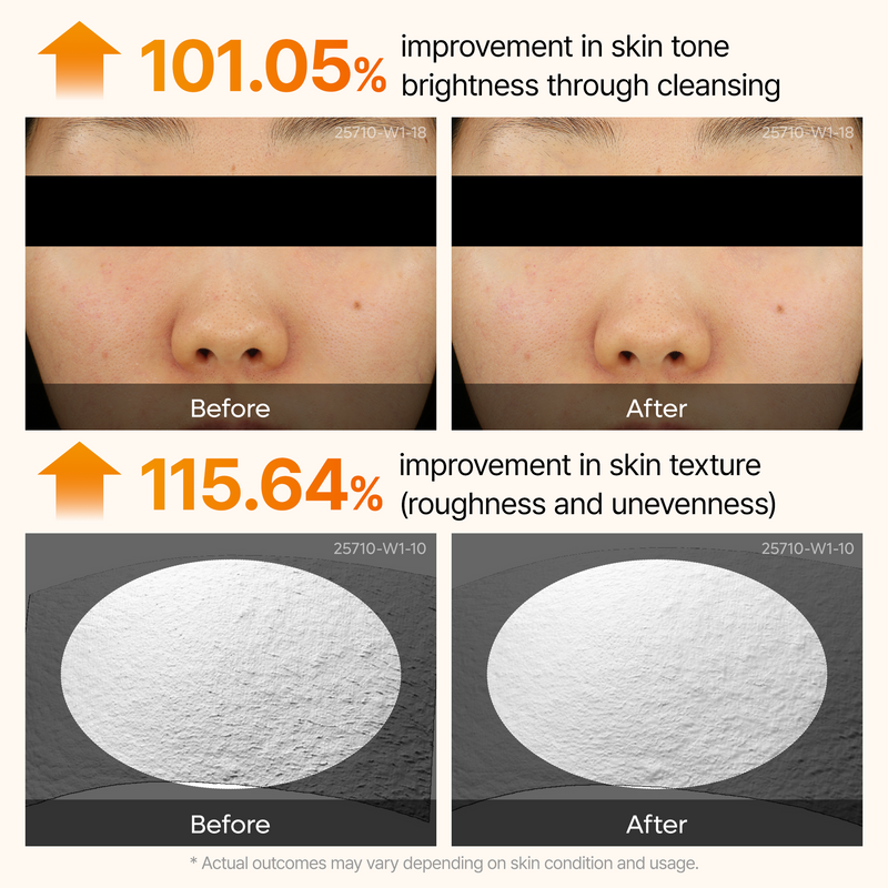[FREE GIFT]🏆 #1 ON TIKTOK | 10-Step Skin Renewal Routine Set