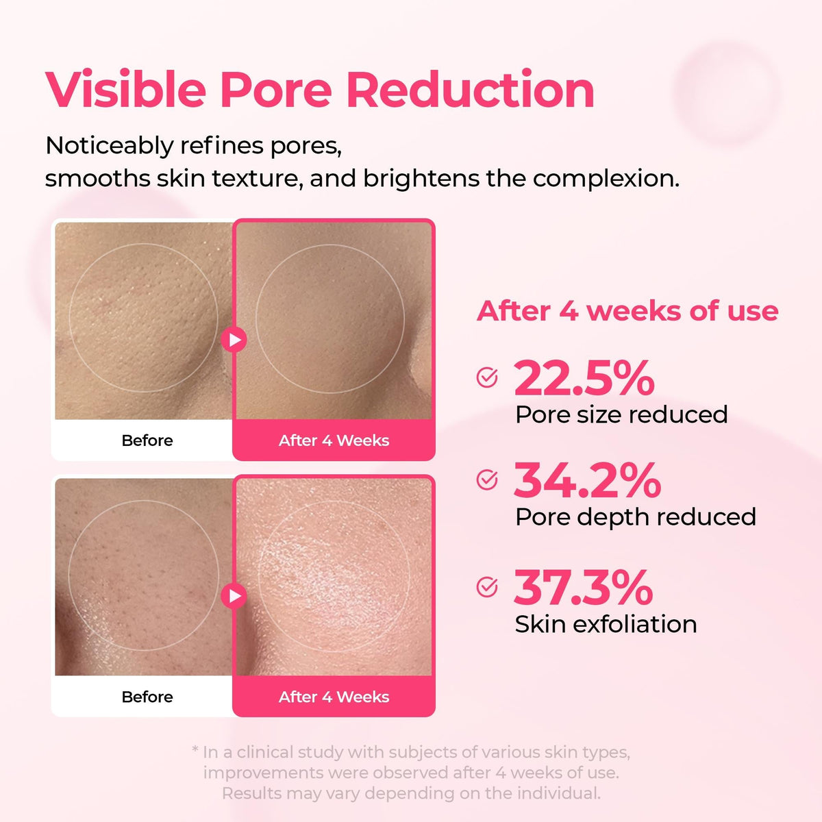[FREE GIFT] 🏆 ALL-TIME BESTSELLER | 5-Piece Collagen Boost Firming Set
