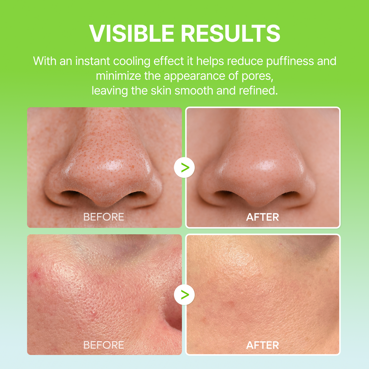 [FREE GIFT]🏆 #1 ON TIKTOK | 10-Step Skin Renewal Routine Set