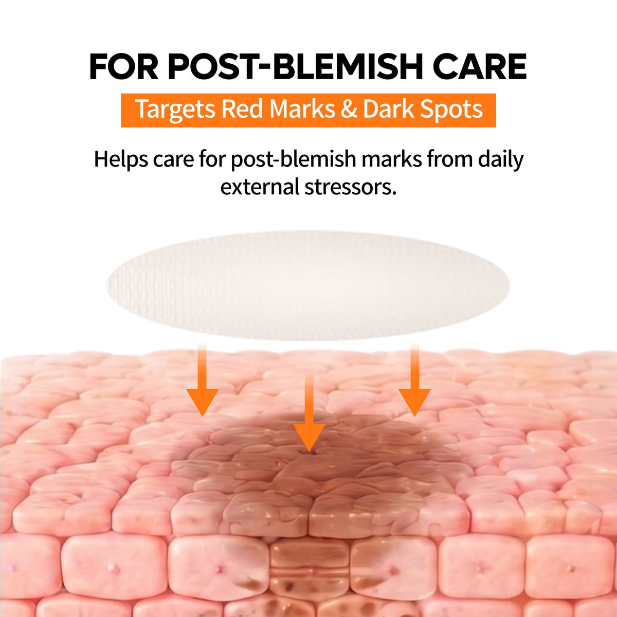 Trending Product | Zero-Fit Blemish & Dark Spot Patch Duo (144 Patches)