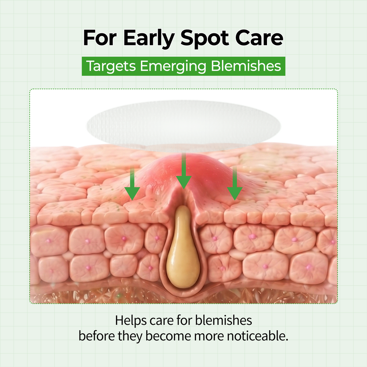 Trending Product | Zero-Fit Blemish & Dark Spot Patch Duo (144 Patches)