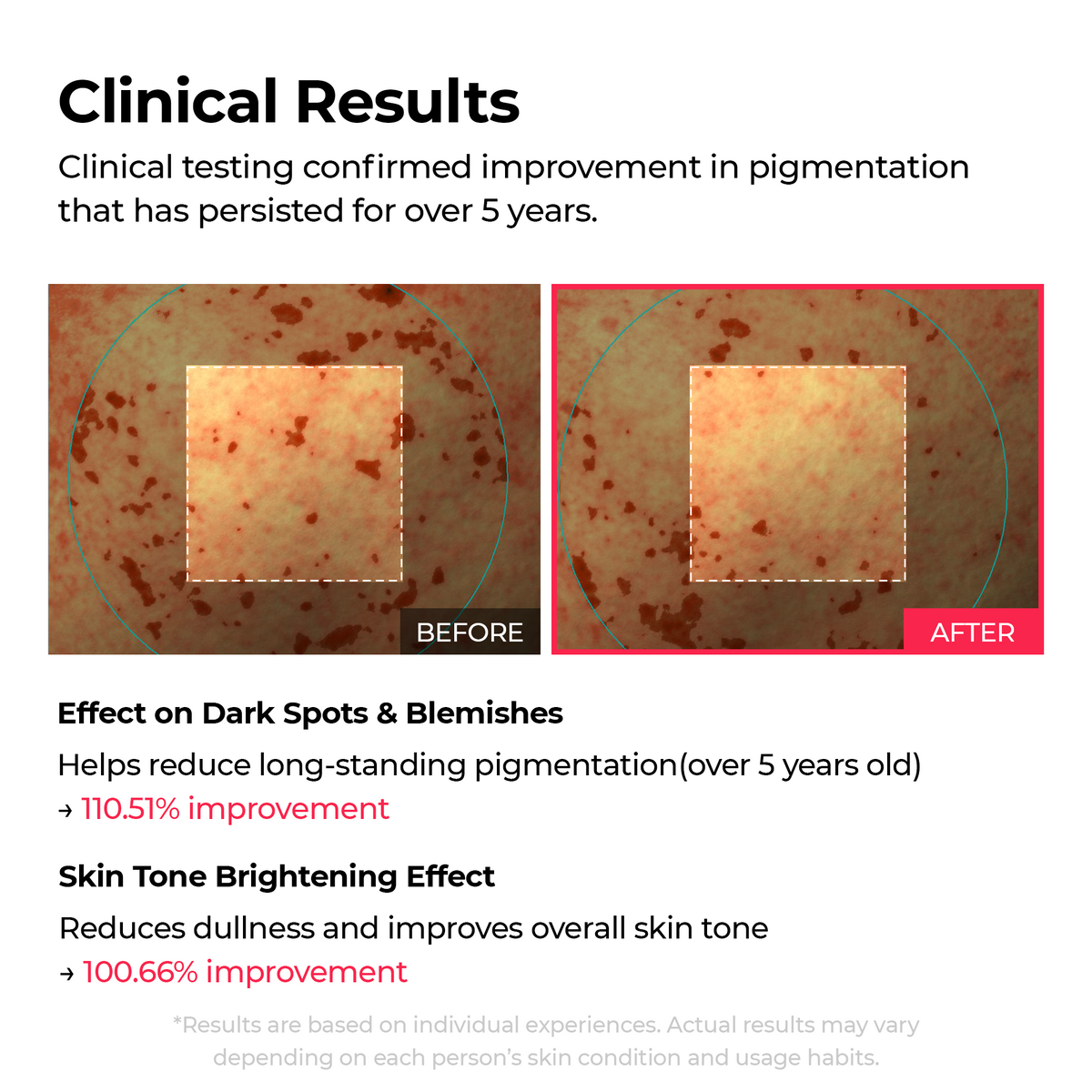 [FREE GIFT]🏆 #1 ON TIKTOK | 10-Step Skin Renewal Routine Set